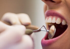 Les chirurgiens-dentistes hors Union Européenne : une situation peu compréhensible !