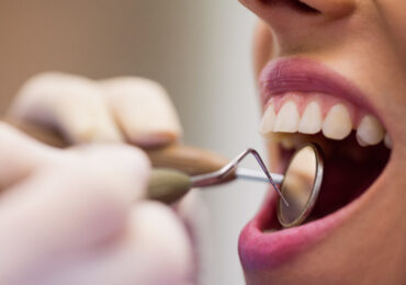 Les chirurgiens-dentistes hors Union Européenne : une situation peu compréhensible !